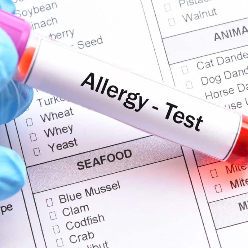 Why are Food Allergies on the Rise
